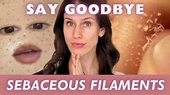 How To Get Rid Of Sebaceous Filaments