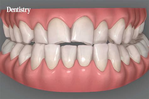 treatment_planning - Dentistry.co.uk