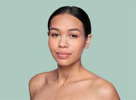 Complete Guide to Rhinoplasty/Nose Job | Perfect Doctors Clinic