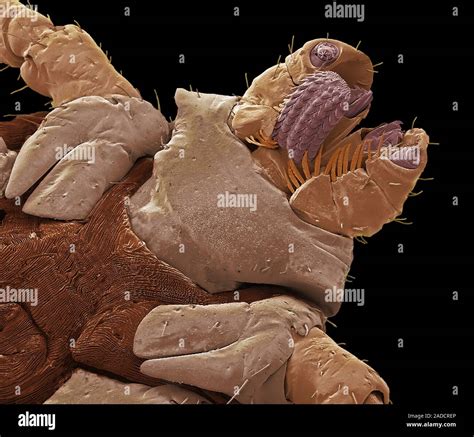 American dog tick mouth parts (Dermacentor variabilis). Scanning electron micrograph (SEM). This ...