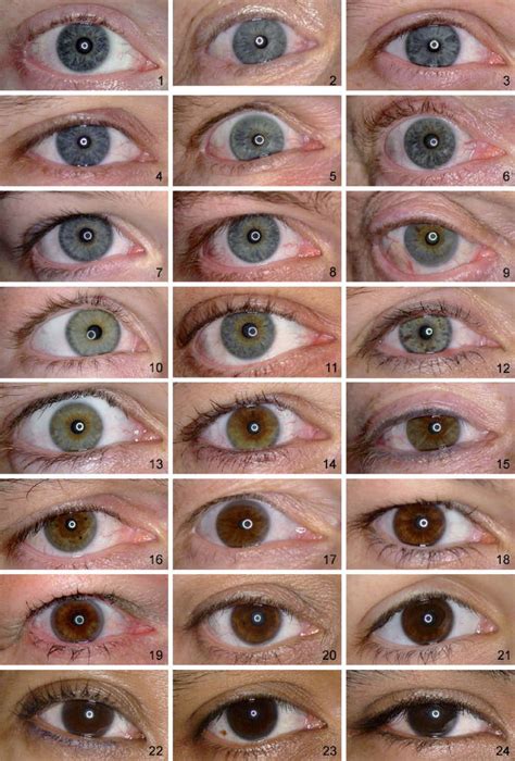 Different Shades Of Blue Eyes Chart