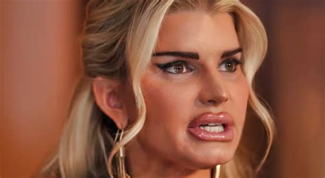 Jessica Simpson Is Completely Unrecognizable: Tony Romo's Ex Shocks Fans With Botched Plastic ...