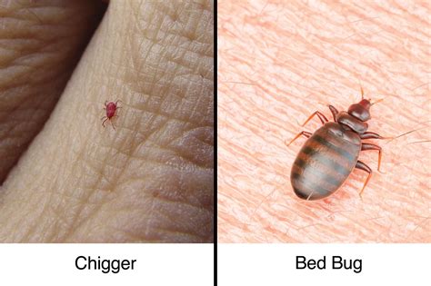 Chiggers Vs Bed Bugs