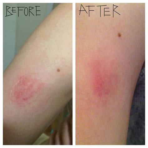 Дневник gardenip3c : LiveInternet - Российский Сервис Онлайн-Дневников