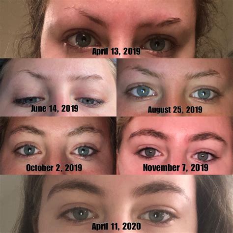 1 year of eyebrow growth | How to grow eyebrows, Growing out eyebrows ...