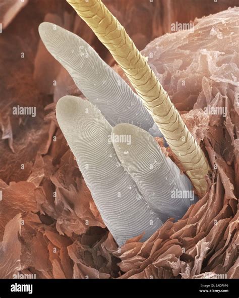 Eyelash mite tails. Coloured scanning electron micrograph (SEM) of the ...