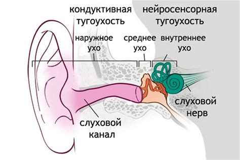 Тугоухость: причины, симптомы, диагностика и лечение