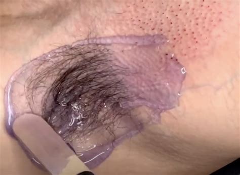 Pinpoint Bleeding Waxing: 9 Alarming Realities – WAX WAX