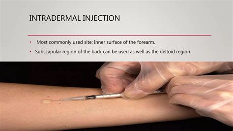 Types of injection | PPTX