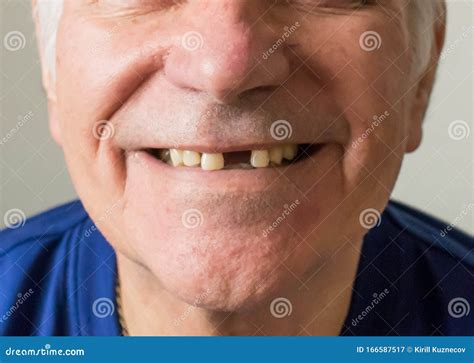 Funny Black Guy With Missing Teeth at Buddy Franzen blog