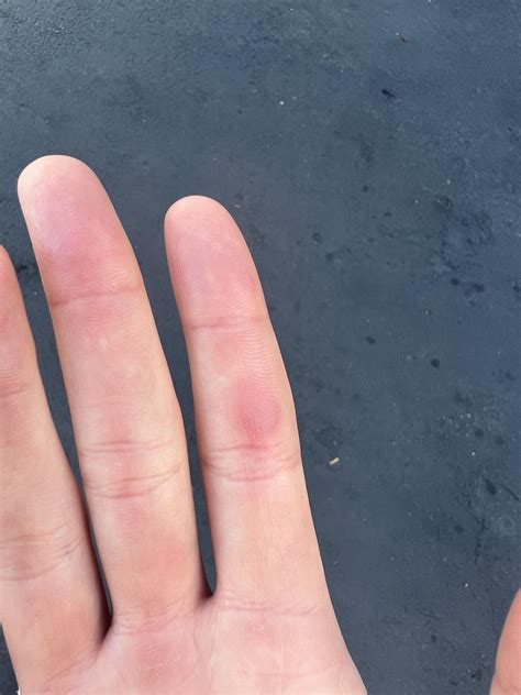 what is this on my finger : r/SkincareAddicts