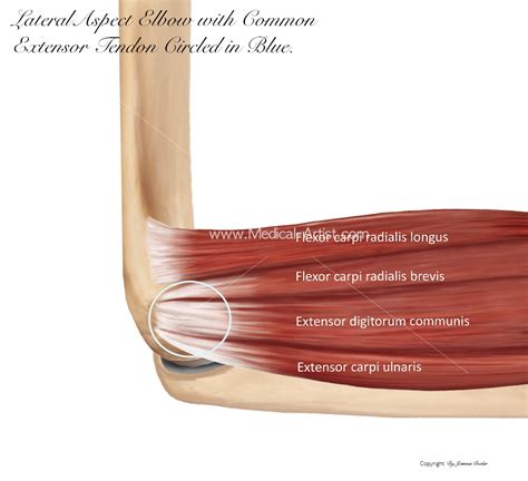 The Climbing Bible - Managing Injuries - Medical Artist