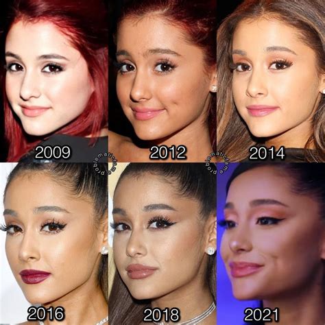 Ariana Grande Nose Job Before And After