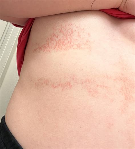 DermatologyQuestions | Got Skin Problems? Get Answers.