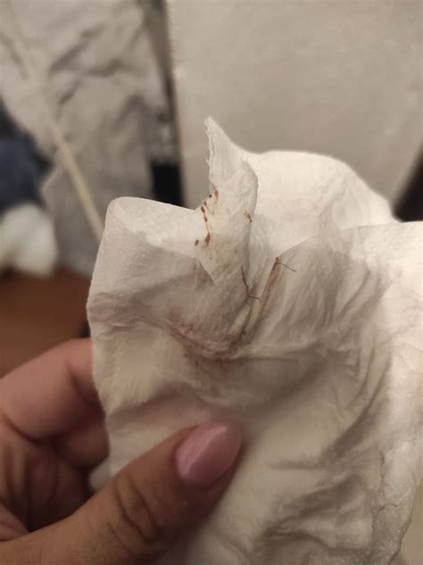 What Does Implantation Bleeding Look Like On Toilet Paper