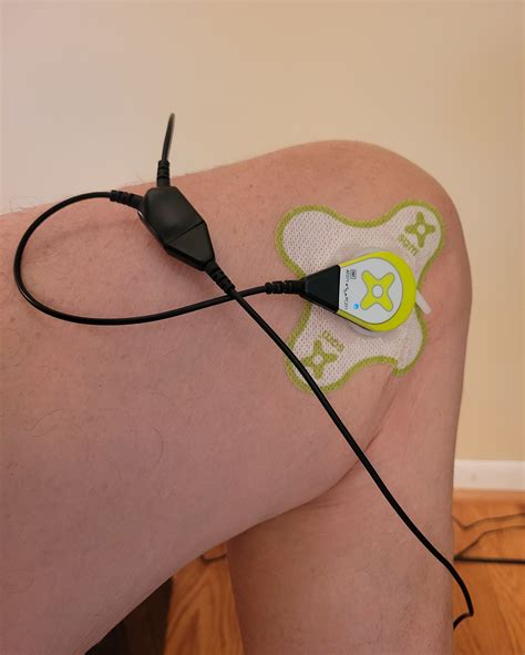 ZetrOZ Systems' sam Wearable Ultrasound Device Helps Osteoarthritis Patient Get Back to Living ...