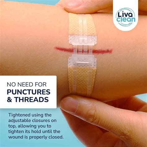 3.7 Zip Strips Wound Closure Device - 3CT First Aid Kit - Steri Strips ...