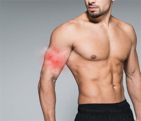 Why CO₂ Cryotherapy Is the Icy Answer to Hot Inflammation? - Rheinlaser Cryotherapy