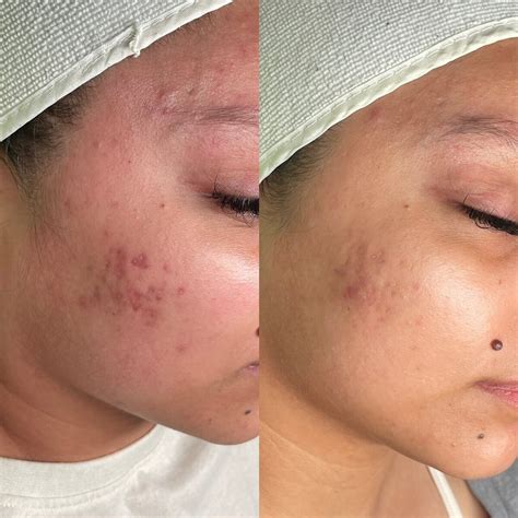 Pore-Clogging Ingredient Checker Tool | Vixen Esthetics