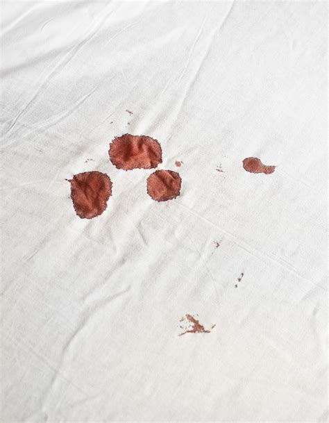 What is the vaginal fornix? | The Fornix | Flex