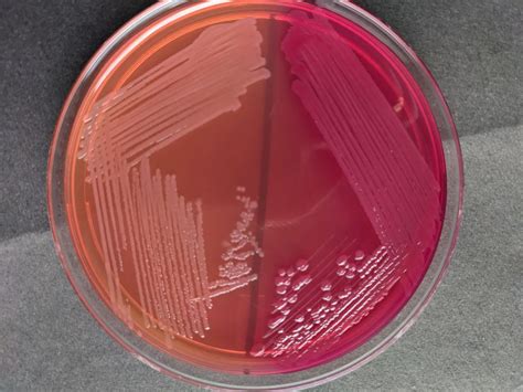 MacConkey Agar: Composition, Uses, Colony Characteristics