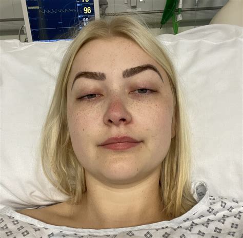 Barbie butt surgery | by Summer - Eakin Healthcare