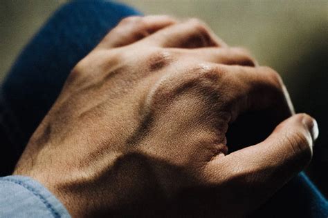 Why the Veins in Your Hands are Bulging | MIMIT Health - MIMIT Health