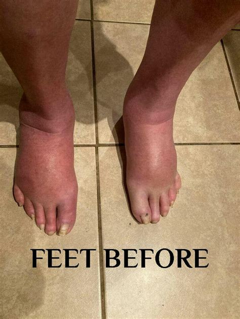 Lymphatic Support Herbal Liquid Supplement - MaryRuth Organics