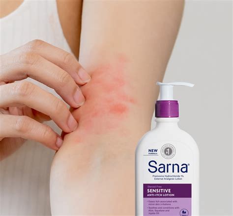 Sarna Sensitive Steroid-Free Anti-Itch Lotion | NEA Accepted