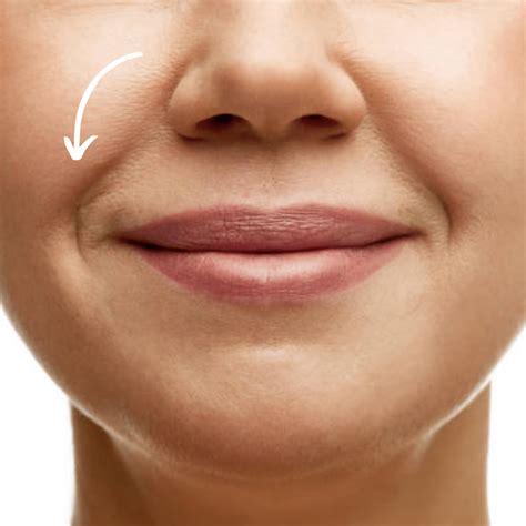 Achieve Smoother Skin with Nasolabial Folds Treatment