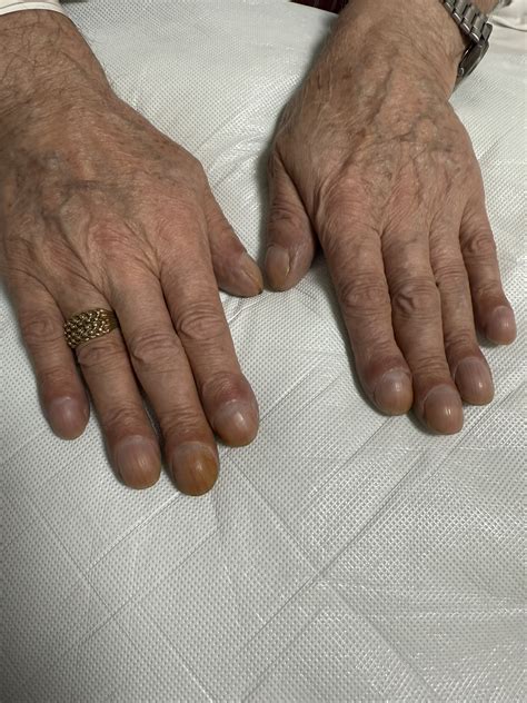 MRCP PACES Exam Dates and Preparation Time 2025: Everything You Need To Know