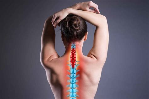 Prolapsed or Herniated Disc in the Neck - Blackberry Clinic