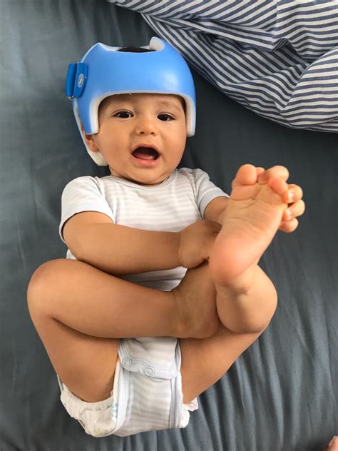 Why Does My Baby Have To Wear A Helmet at Alfredo Orvis blog
