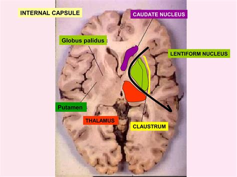 Internal capsule | PPT