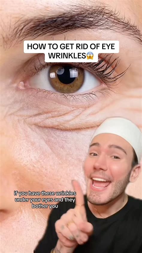 Matt Randon 🧩 on Instagram: "HOW TO GET RID OF EYE WRINKLES!😱 (follow ...
