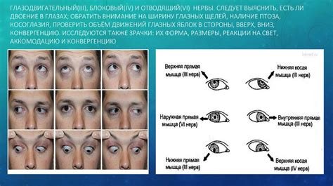 Введение в неврологию. Диагностика нервных болезней - online presentation