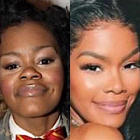 Teyana Taylor Before And After Nose Job