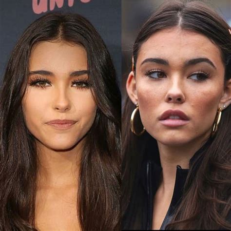 Madison Beer plastic surgery | Cheek fillers, Botox lips, Eyebrow lift