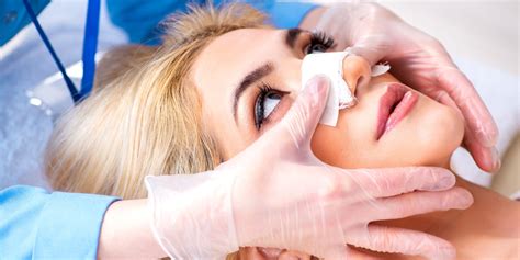 Can An X-Ray Show A Broken Nose? - Zwivel