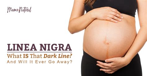 Linea Nigra: What IS That Dark Line? And Will It Ever Go Away?