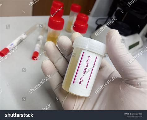 Urine Drug Screen Sample Phencyclidine Pcp Stock Photo 2133234019 ...