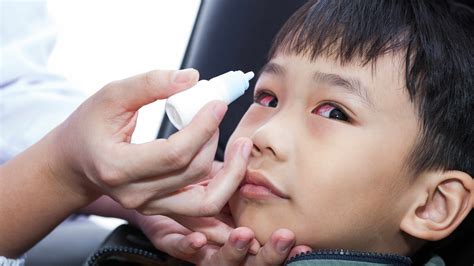 Eye Irritation, Abrasion or Pink Eye: When to See an Eye Doctor - Mayo ...