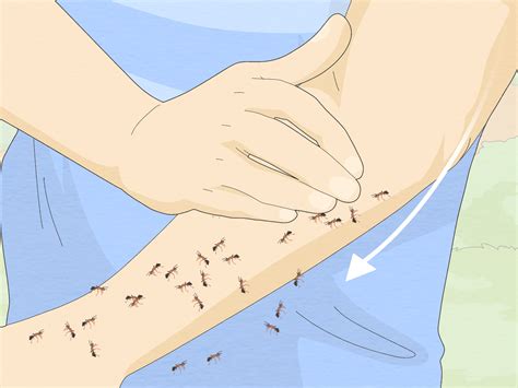 7 Ways to Treat a Fire Ant Sting - wikiHow