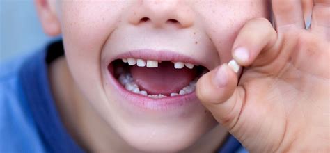 Should You Tighten a Loose Tooth at Home? What Parents Need to Know ...