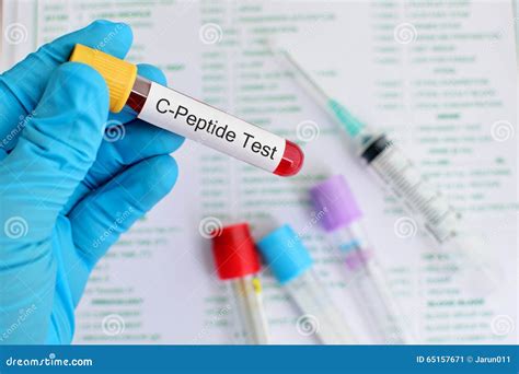 C-Peptide test stock image. Image of hematology, health - 65157671