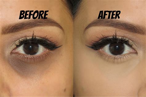 Dark Circles Under Eyes Kajal at Jaxon Quintanar blog