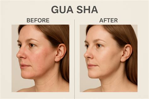 Gua Sha Before and After – Pay Attention to These