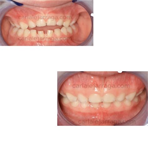 Thumb Sucking Professionals (BD) - The Thumbsucking Clinic