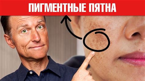 Темные пятна на коже, что это такое, фото на коже и как избавиться
