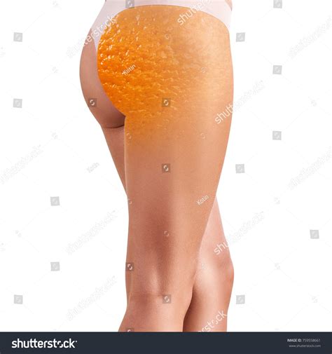 Cellulite On Butt
